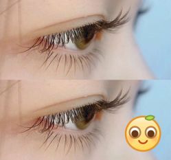 -初樱科技美学问题肌修复中心