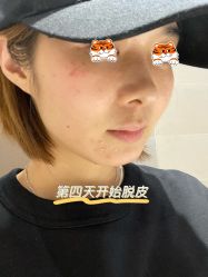 -agge蛋白医美