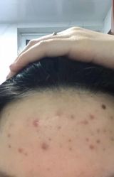 -晶禾臻语·问题肌研究所