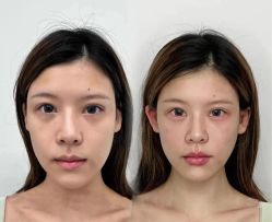 -Yestar 嘉兴艺星医疗美容医院