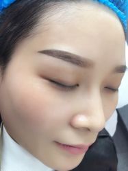 点击看大图 -郡艺医疗美容·微整·眼鼻吸脂