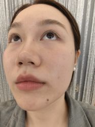 -长沙雅美医疗美容医院