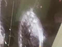 -张钰强中医正骨推拿连锁(华发商都店)