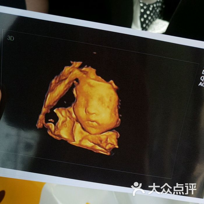 人之初四维彩超摄影