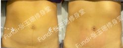 -Fundi张玉珊修身堂·indiba·BTL科技瘦身