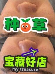 点击看大图 -skin79皮肤管理中心