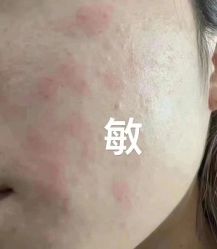 -MLP美丽派·问题肌疗愈中心