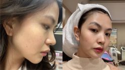 -厦门美莱整形美容医院