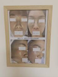 -美肤盾祛痘·问题肌头疗管理中心