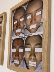 -美肤盾祛痘·问题肌头疗管理中心