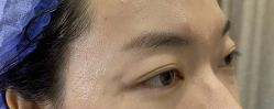 点击看大图 体验前-重庆联合丽格第五医疗美容医院