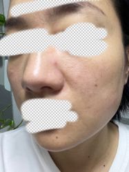 体验后-北京博泽医疗美容门诊部