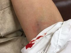 -上海市浦东新区人民医院·门诊