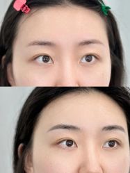 -张小野·专业半永久纹眉