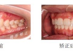 -Dr.Z dental仁康种植矫正中心