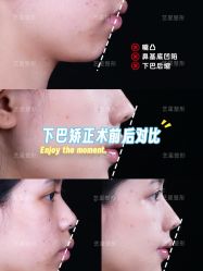 -Yestar艺星医疗美容医院