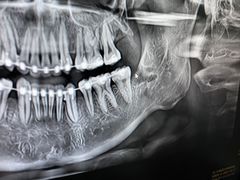 -牙博士口腔品牌连锁(杨浦店)