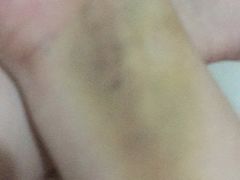 -重庆医科大学附属第一医院(本部)