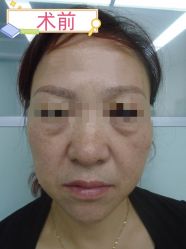 -素美医疗美容·西南眼鼻整形·修复基地