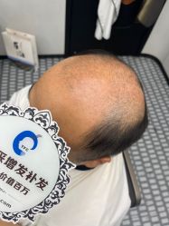 -唐风采假发补发定制