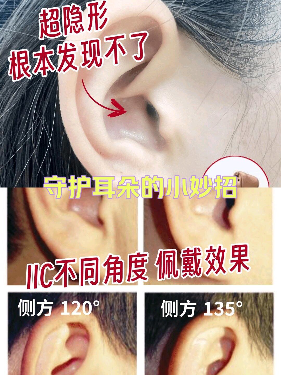 带大家了解一下隐形深耳道式助听器iic(上图)
✅外观最小的助听器