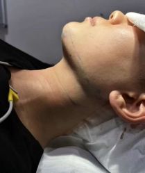 -东莞西妃整形美容医院