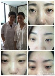 -美丽人生祛斑扁平疣汗管瘤中心