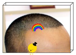 -大麦微针植发全国连锁