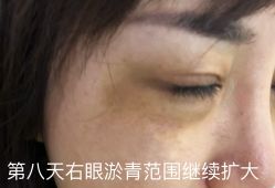 -上海时光整形外科医院