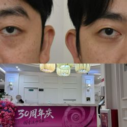 -广州健丽·去眼袋医疗美容机构