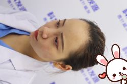 点击看大图 -大麦微针植发丨全国连锁