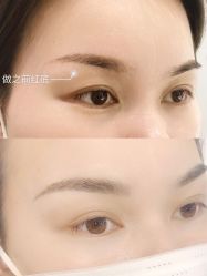 -MIVI半永久纹眉绣眉