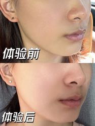 -美瑞莎创美医疗美容