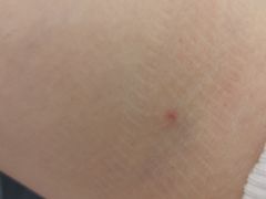 -普惠健康体检中心(西安未央体检中心)