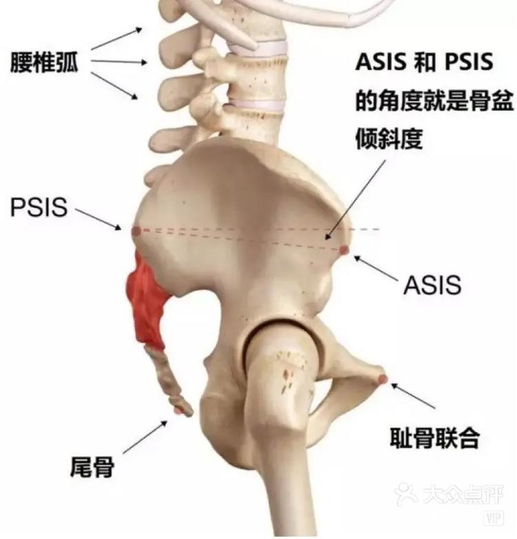 髂后下棘图片图片