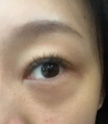 体验前-深圳广和门诊部·整形医疗美容