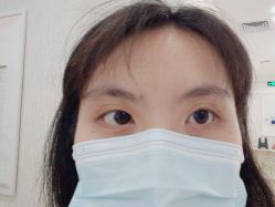 点击看大图 -广州健丽·去眼袋医疗美容机构