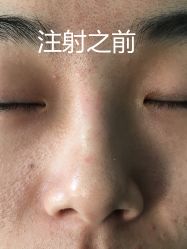 -八大处整形