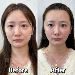 -颜和骨正·明哲式骨相美学整骨