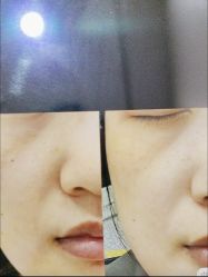 -郡艺医疗美容·微整·眼鼻吸脂