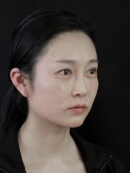 -Yestar重庆艺星医疗美容医院