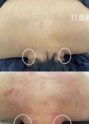 -智丽佳人祛斑祛痘美容美体