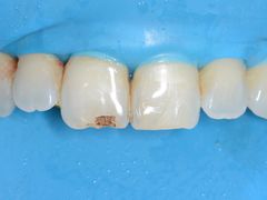 -新达口腔(华东理工大学店)