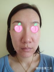 -和颜一美轻医美连锁