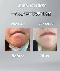 -LUNA皮相美·骨相美高级美感