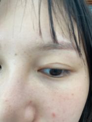 -广州美莱医疗美容医院