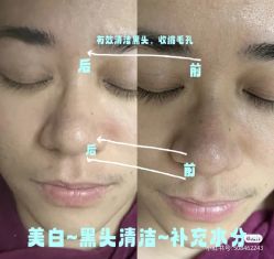 -安吉拉青春化管理中心