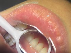 -土豆口腔(凤凰北总店)