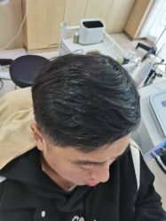 -大麦微针植发丨全国连锁