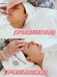 -紫御国际抗衰ZOE ANTI AGING